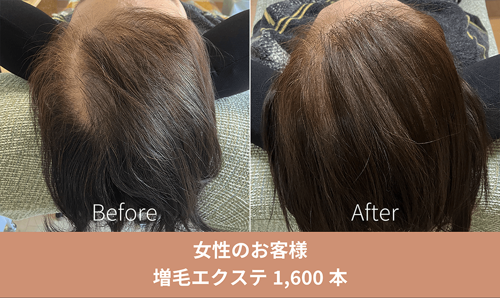 増毛エクステ施術事例