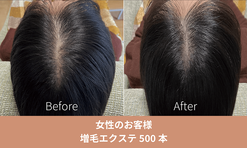 増毛エクステ施術事例