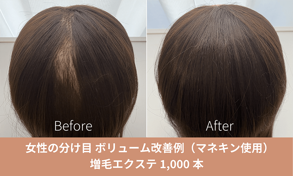 増毛エクステ施術事例