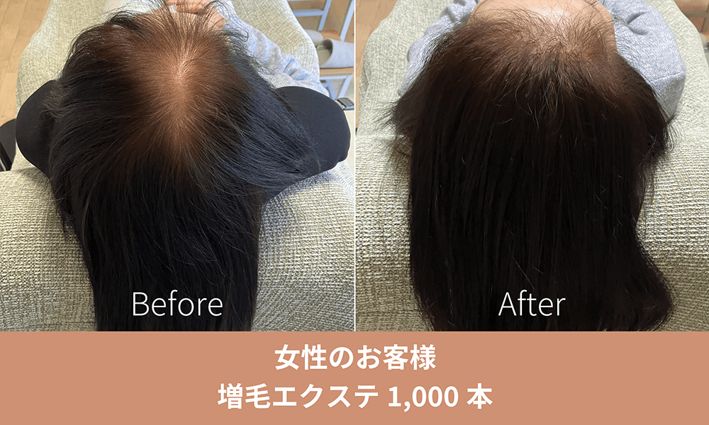 増毛エクステ施術事例