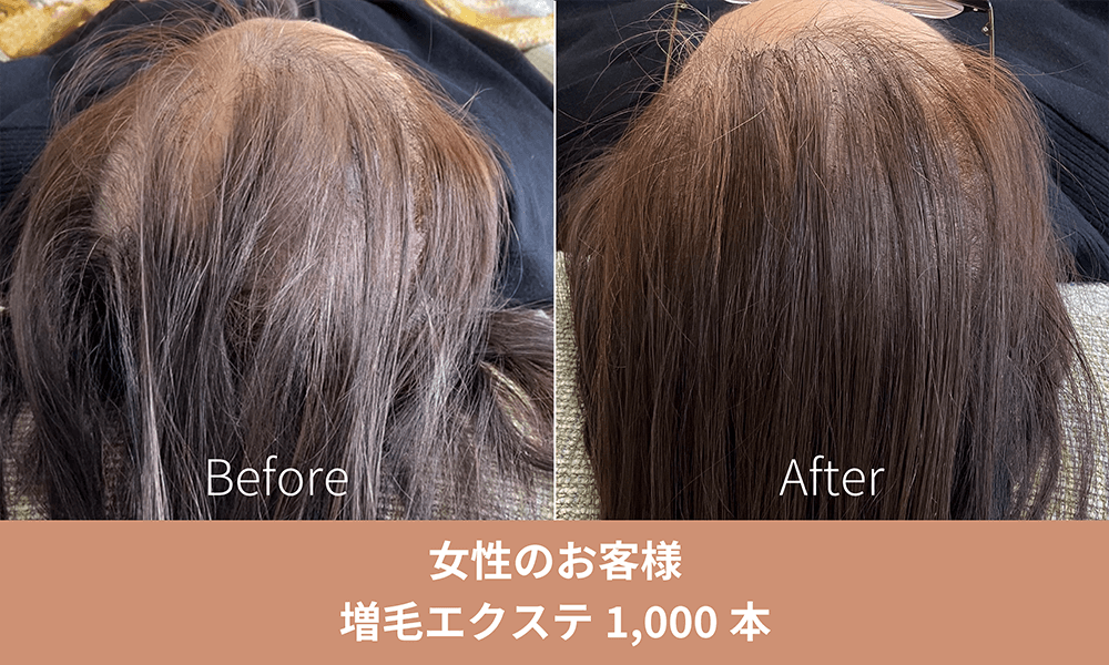 増毛エクステ施術事例