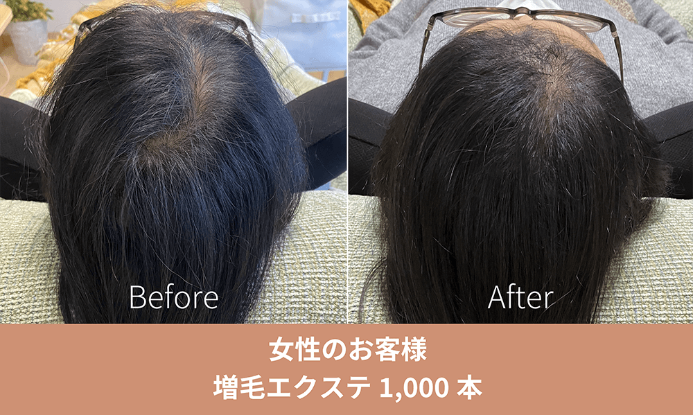 増毛エクステ施術事例