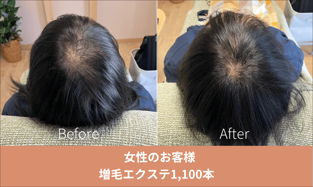 増毛エクステ施術事例