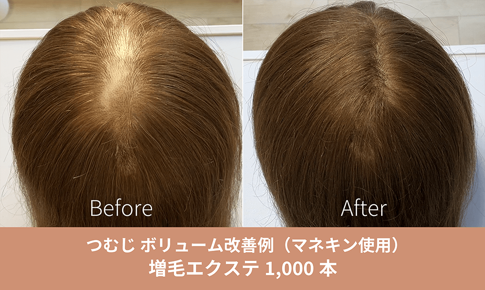 増毛エクステ施術事例