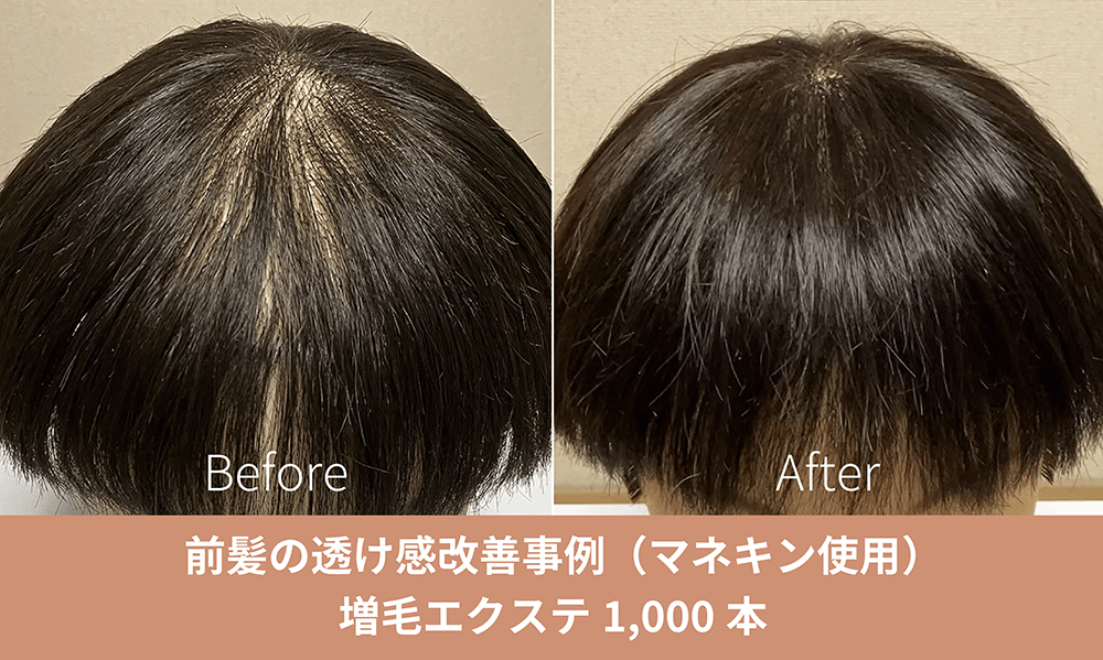 増毛エクステ施術事例