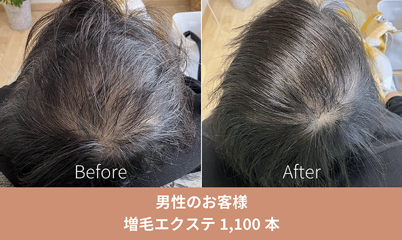 増毛エクステ施術事例