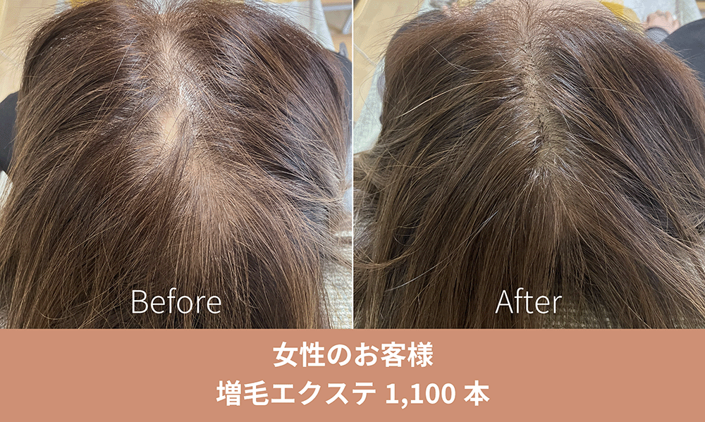 増毛エクステ施術事例
