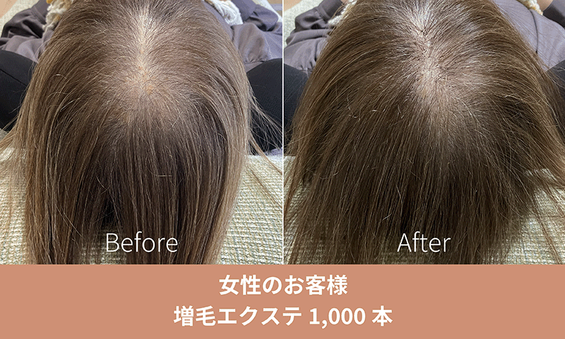 増毛エクステ施術事例